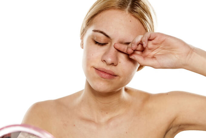 専門医に聞く。“目”にくる花粉症は、点眼薬＆点鼻薬でのケアがおすすめ。
