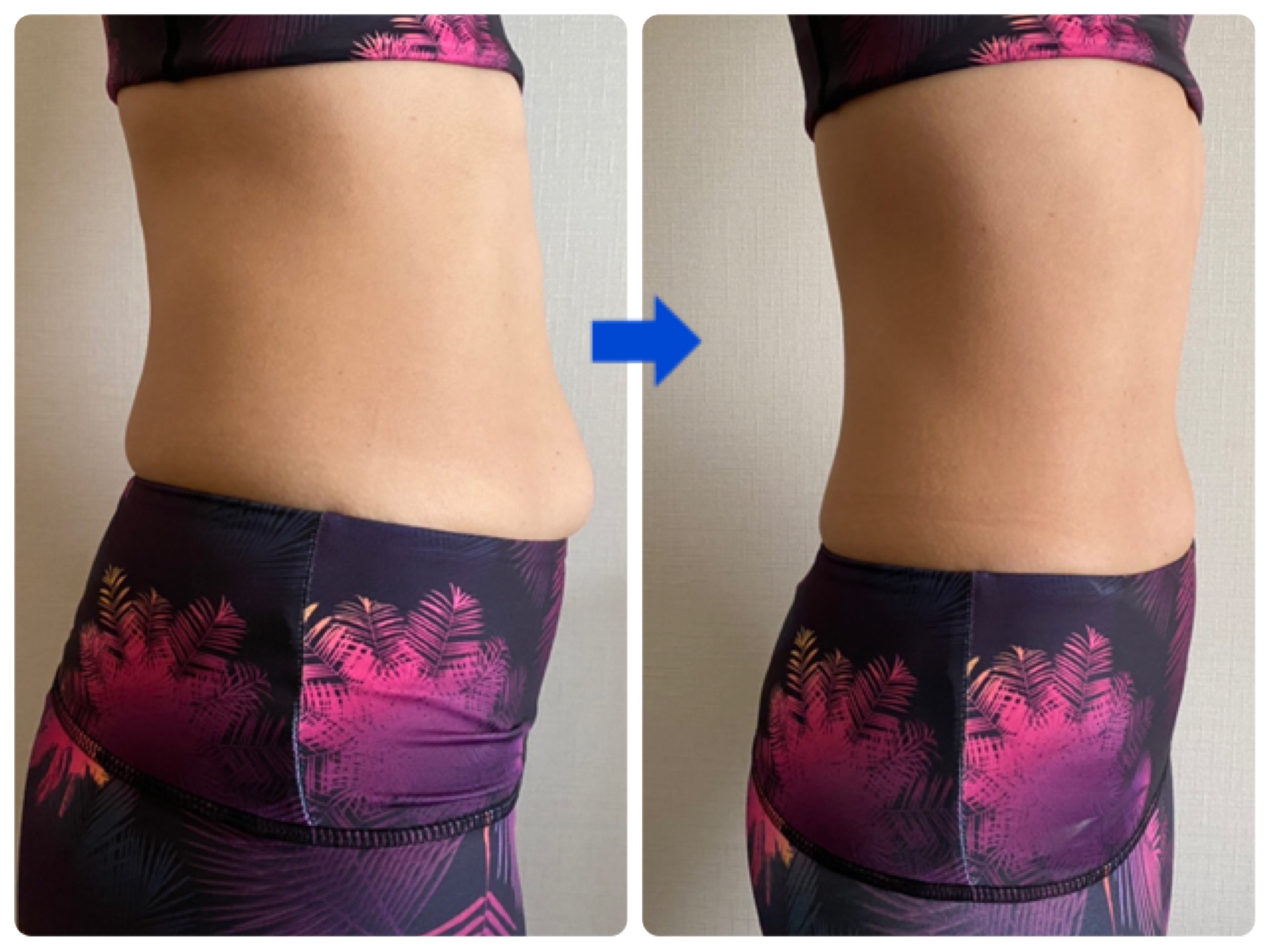 １週間でお腹 ８ 毎日快便になってすっきり ミオドレ式腸マッサージ ダイエット フィットネス ヘルスケアのことならfytte フィッテ