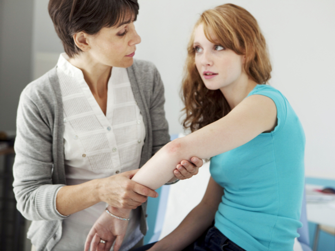 膝の乾癬性関節炎