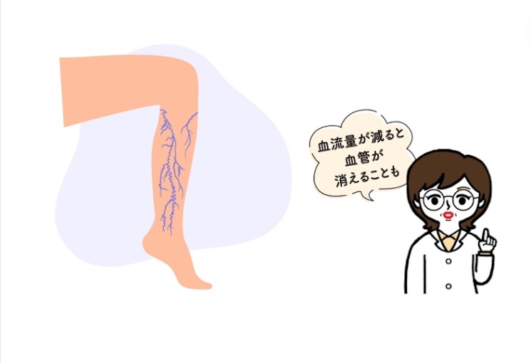 冷え知らず先生と足の血液循環が悪くなっているイメージのイラスト