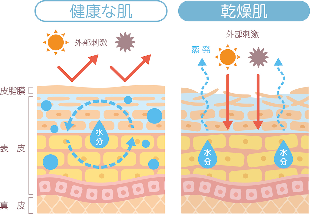 健康な肌と乾燥肌