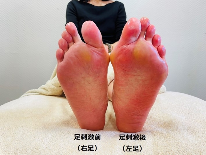 ●足刺激前（右足）と足刺激後（左足）の足相