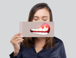 全身のさまざまな病気に関係する歯周病。アラフォー以降に歯周病が増加してしまうのは、なぜ？