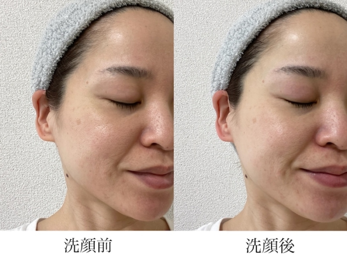 アンプルショット バブルエステ 炭酸洗顔フォームの使用前と後