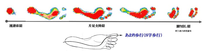 あおり歩行のしかた