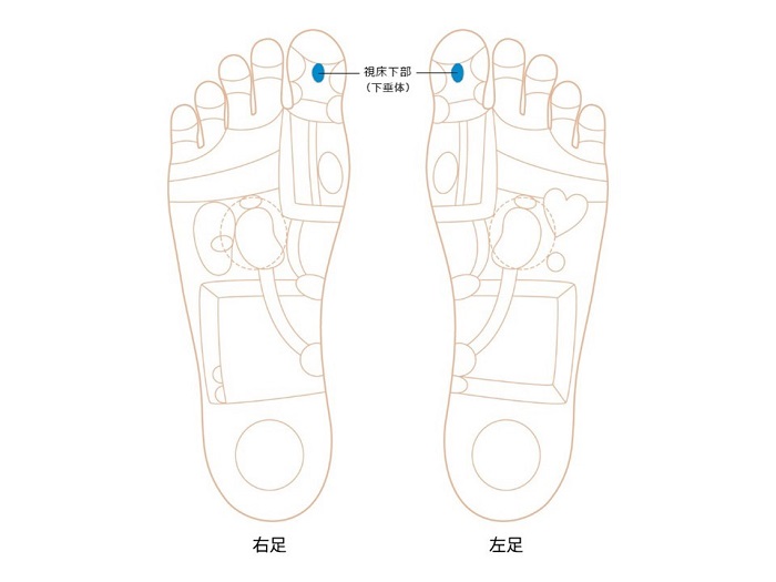 視床下部ゾーン画像