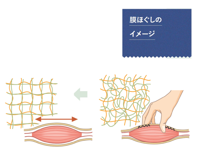 膜ほぐし