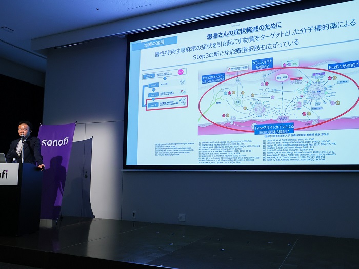 慢性特発性じんましん（CSU）セミナー