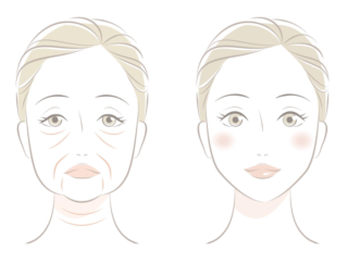 40代から急増！ 顔のたるみは骨から始まる!? 整形外科医が教える「骨活」で見た目も若々しく