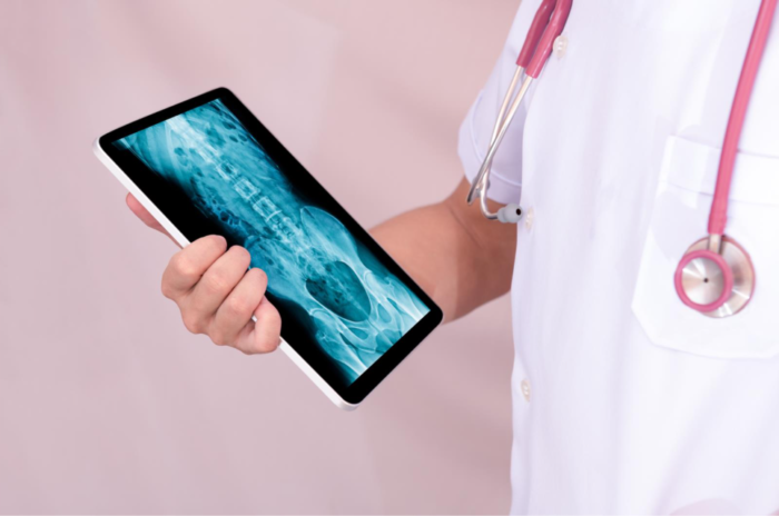 ドクターと骨の画像が写ったタブレット