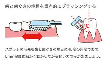 ブラッシングのやり方