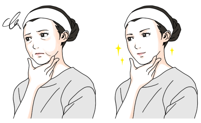 顔のたるみに悩む女性のイラストビフォーアフター