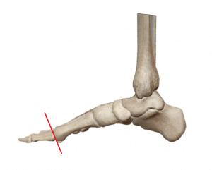 足の親指のつけ根のMP関節