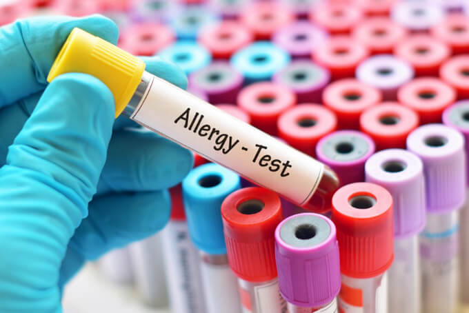 アレルギーテストのイメージ