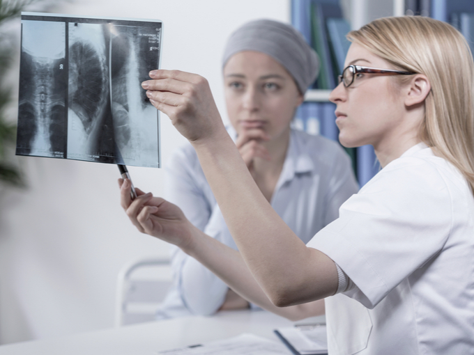肺のレントゲン写真を患者に見せるドクター